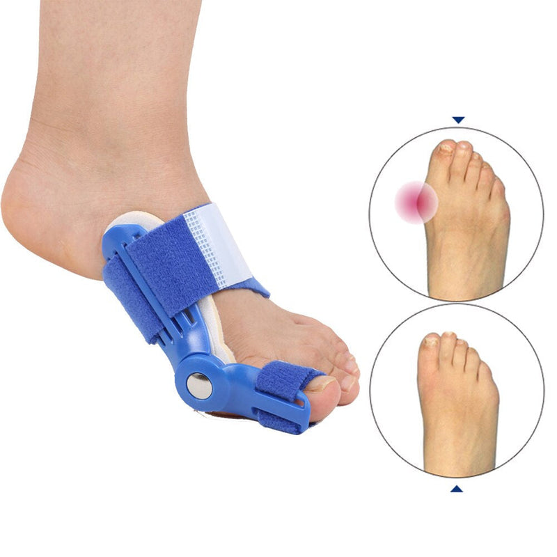 Corrective Splint for Hallux Valgus (1 Pair) - BunionFix