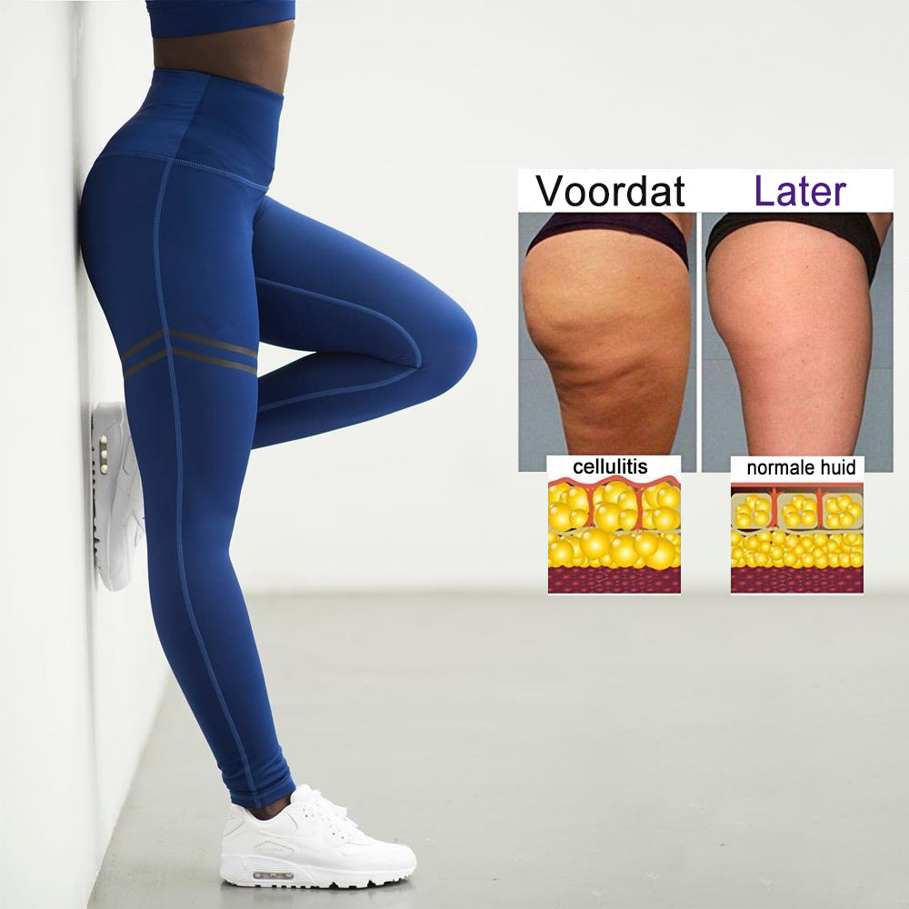 Anti-Cellulite Compression Leggings for Women - SculptFit