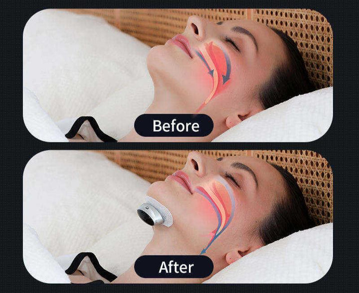 Sleep Apnea Aid - AirEase