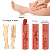 Voetmassage Mat - AcupressureFlow