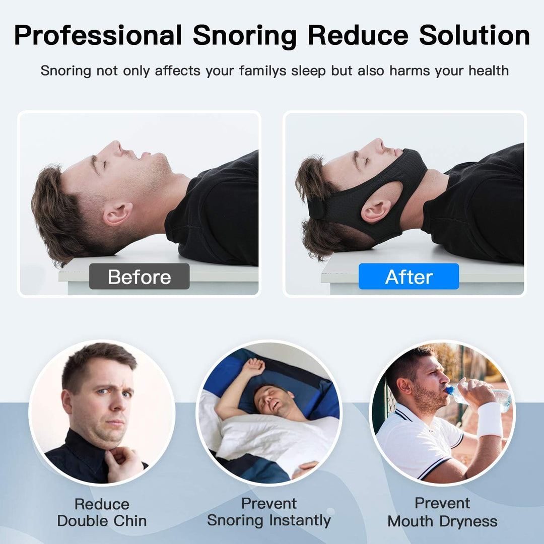 Anti-Snore Chin Strap - DreamQuiet