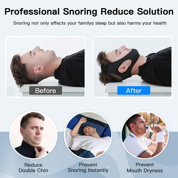 Anti-Snore Chin Strap - DreamQuiet