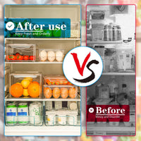 Stackable Refrigerator Organizer Set of 10 - FridgeMaster