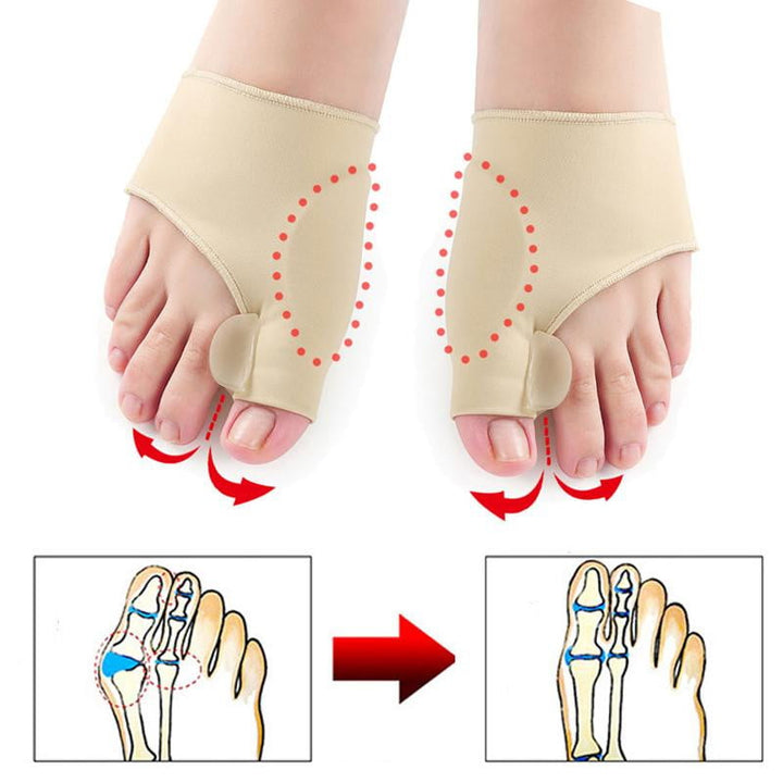 Ochraniacz na haluksy (1 para) - OrthoBunion