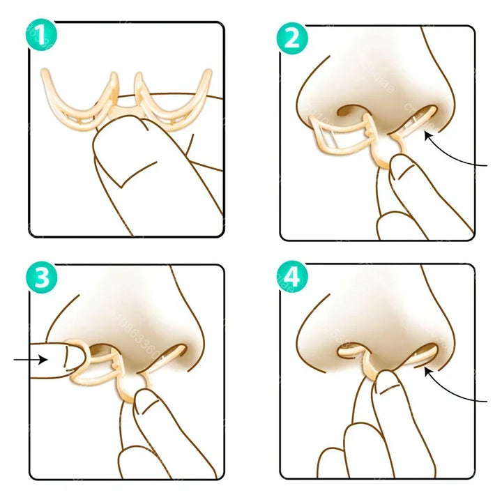 Comfortable Anti-Snoring Device - AirEase