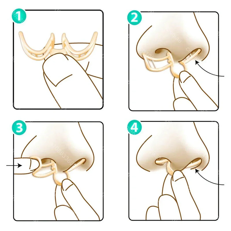 Comfortable Anti-Snoring Device - AirEase
