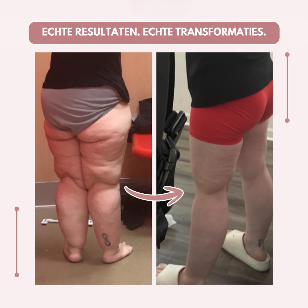 Voor-en-nabeeld van de benen van achteren: links zonder legging, rechts met aansluitende kleding, met pijl ertussen en Duitse tekst. 10