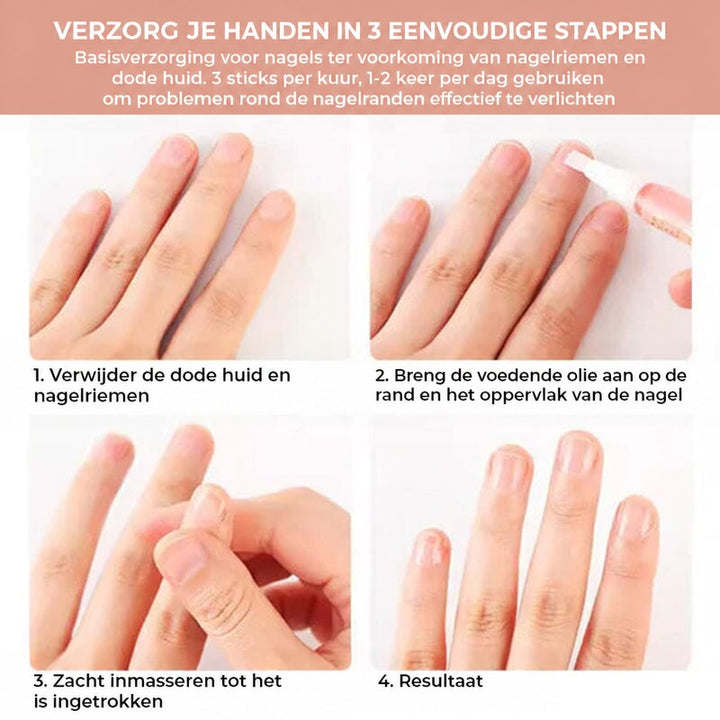 Vier stappen in beeld: dode huid verwijderen, olie aanbrengen op de nagelrand, inmassBeLEGEN en het resultaat 5