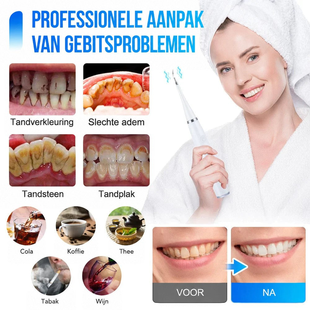 Vrouw in witte badjas gebruikt de witte tandreiniger, met voorbeelden van tandverkleuring en tandsteen en een voor-en-nadat-vergelijking van tanden. 2