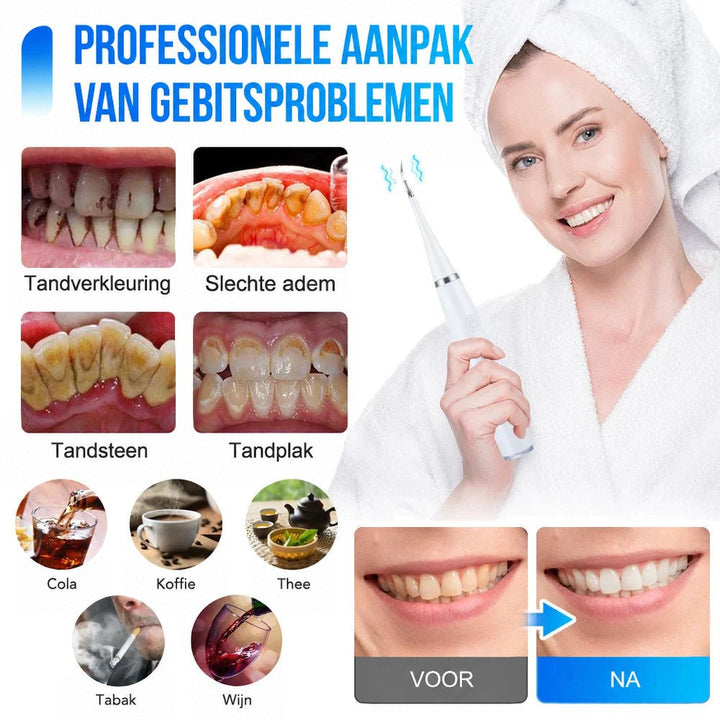 Vrouw in witte badjas gebruikt de witte tandreiniger, met voorbeelden van tandverkleuring en tandsteen en een voor-en-nadat-vergelijking van tanden. 2