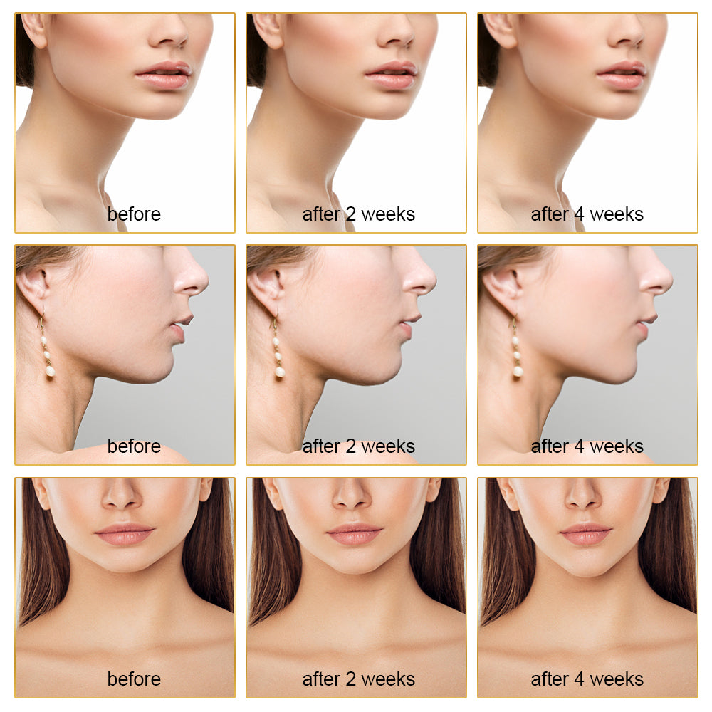 EMS FACIAL TONER WITH LED THERAPY - SLIMMER FACE AND DOUBLE CHIN REMOVAL
