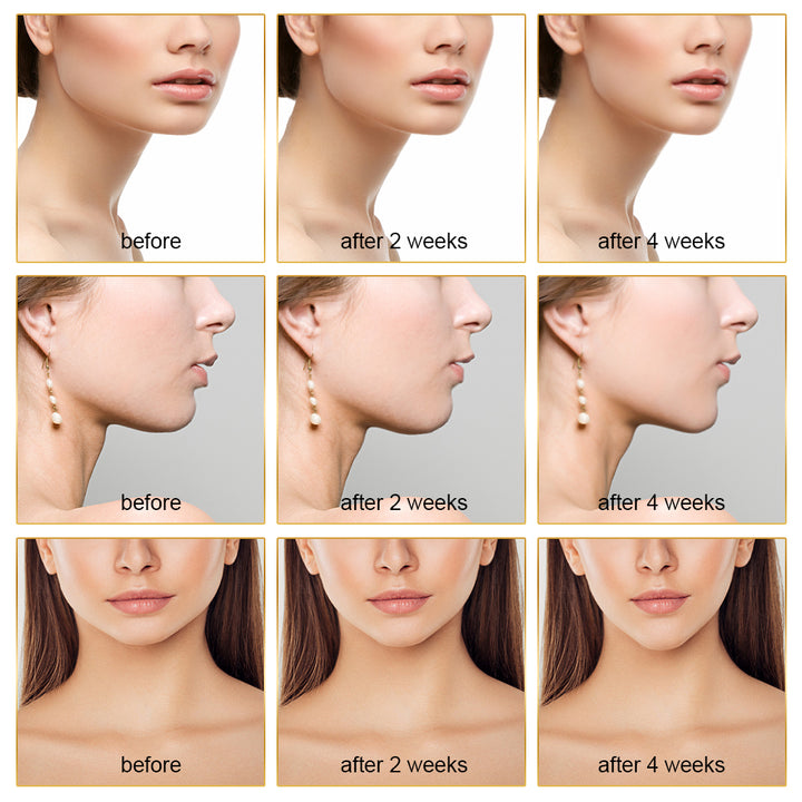 EMS FACIAL TONER WITH LED THERAPY - SLIMMER FACE AND DOUBLE CHIN REMOVAL