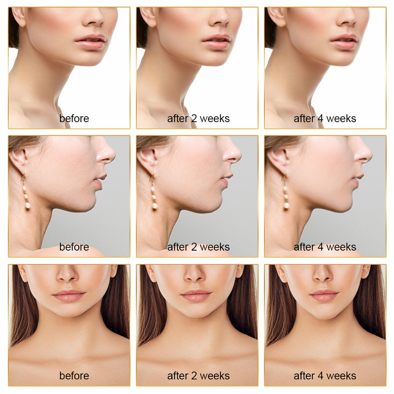 EMS FACIAL TONER WITH LED THERAPY - SLIMMER FACE AND DOUBLE CHIN REMOVAL