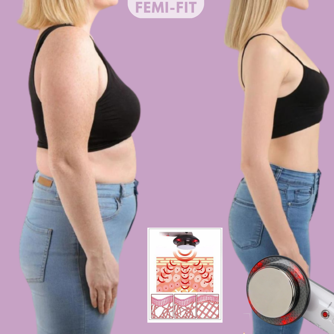 3-w-1 Usuwacz tłuszczu i cellulitu - SlimShape