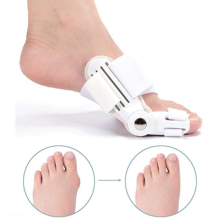 Corrective Splint for Hallux Valgus (1 Pair) - BunionFix