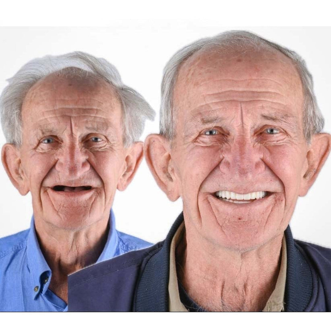 Voor-en-nafoto van een oudere man: links met een tandeloze mond, rechts met een brede glimlach en witte tanden. 6